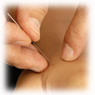 acupuncture